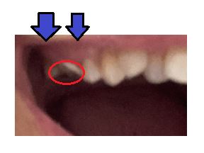 画像に alt 属性が指定されていません。ファイル名: 4db88909ab744054adda982444d2dd89.jpg